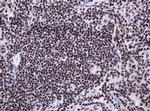 DCPS Antibody in Immunohistochemistry (Paraffin) (IHC (P))