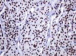DCPS Antibody in Immunohistochemistry (Paraffin) (IHC (P))