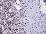 DCPS Antibody in Immunohistochemistry (Paraffin) (IHC (P))