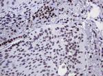 DCPS Antibody in Immunohistochemistry (Paraffin) (IHC (P))