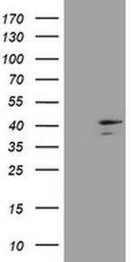DCPS Antibody in Western Blot (WB)