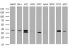 DCPS Antibody in Western Blot (WB)