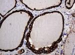 POGK Antibody in Immunohistochemistry (Paraffin) (IHC (P))