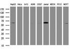 POGK Antibody in Western Blot (WB)