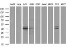 PARVB Antibody in Western Blot (WB)