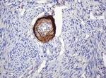 PARVB Antibody in Immunohistochemistry (Paraffin) (IHC (P))