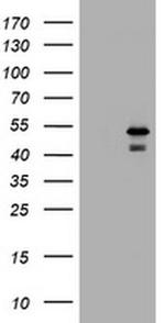 PARVB Antibody in Western Blot (WB)