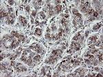 MDMX Antibody in Immunohistochemistry (Paraffin) (IHC (P))