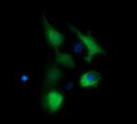 BBOX1 Monoclonal Antibody (OTI1E11)
