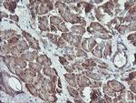 RAB21 Antibody in Immunohistochemistry (Paraffin) (IHC (P))