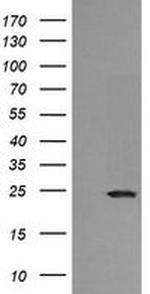 RAB21 Antibody in Western Blot (WB)