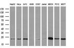 RAB21 Antibody in Western Blot (WB)