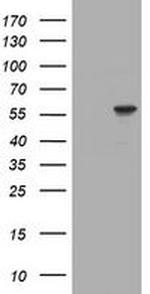 RNF23 Antibody in Western Blot (WB)