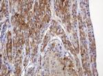 TBC1D13 Monoclonal Antibody (OTI2C5)