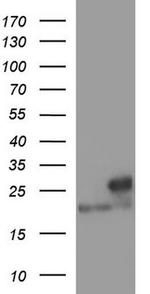 LZIC Antibody in Western Blot (WB)