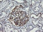 VTI1A Antibody in Immunohistochemistry (Paraffin) (IHC (P))