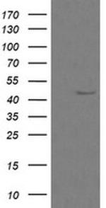 Calreticulin 3 Antibody in Western Blot (WB)