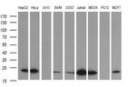 LZIC Antibody in Western Blot (WB)
