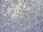 RNF39 Antibody in Immunohistochemistry (Paraffin) (IHC (P))