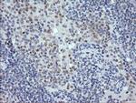 RNF39 Antibody in Immunohistochemistry (Paraffin) (IHC (P))