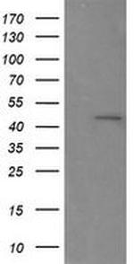 RNF39 Antibody in Western Blot (WB)