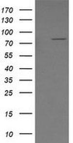 SESTD1 Antibody in Western Blot (WB)