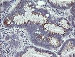 IL1F9 Antibody in Immunohistochemistry (Paraffin) (IHC (P))