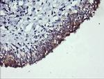 PIK3C2B Antibody in Immunohistochemistry (Paraffin) (IHC (P))