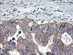 PIK3C2B Antibody in Immunohistochemistry (Paraffin) (IHC (P))