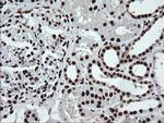 SAE1 Antibody in Immunohistochemistry (Paraffin) (IHC (P))