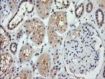RARRES1 Antibody in Immunohistochemistry (Paraffin) (IHC (P))
