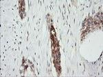 RARRES1 Antibody in Immunohistochemistry (Paraffin) (IHC (P))