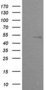 ZNF38 Antibody in Western Blot (WB)