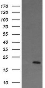 APC11 Antibody in Western Blot (WB)