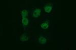 TUBB2B Antibody in Immunocytochemistry (ICC/IF)
