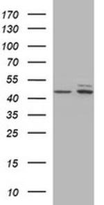 TUBB2B Antibody in Western Blot (WB)