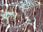 CSH1 Antibody in Immunohistochemistry (Paraffin) (IHC (P))
