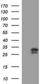 CSH1 Antibody in Western Blot (WB)