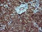 SIVA1 Antibody in Immunohistochemistry (Paraffin) (IHC (P))