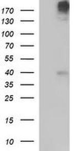 PLB1 Monoclonal Antibody (OTI1D3)