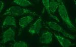 POLR3GL Monoclonal Antibody (OTI5E8)
