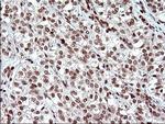 POLR3GL Antibody in Immunohistochemistry (Paraffin) (IHC (P))