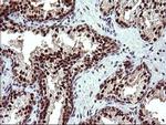 UPRT Antibody in Immunohistochemistry (Paraffin) (IHC (P))