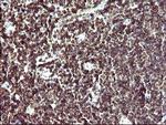 IL10RA Antibody in Immunohistochemistry (Paraffin) (IHC (P))