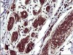 TMX Antibody in Immunohistochemistry (Paraffin) (IHC (P))