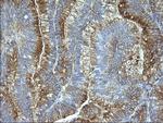 SCAMP2 Antibody in Immunohistochemistry (Paraffin) (IHC (P))