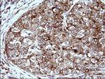SCAMP2 Antibody in Immunohistochemistry (Paraffin) (IHC (P))
