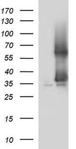 SCAMP2 Antibody in Western Blot (WB)
