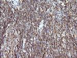 SCAMP2 Antibody in Immunohistochemistry (Paraffin) (IHC (P))