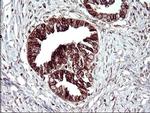 TMX Antibody in Immunohistochemistry (Paraffin) (IHC (P))